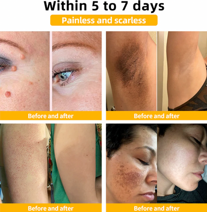 Bee Venom Skin Care Cream